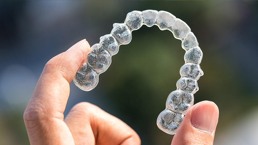 How To Care For Suresmile Aligners